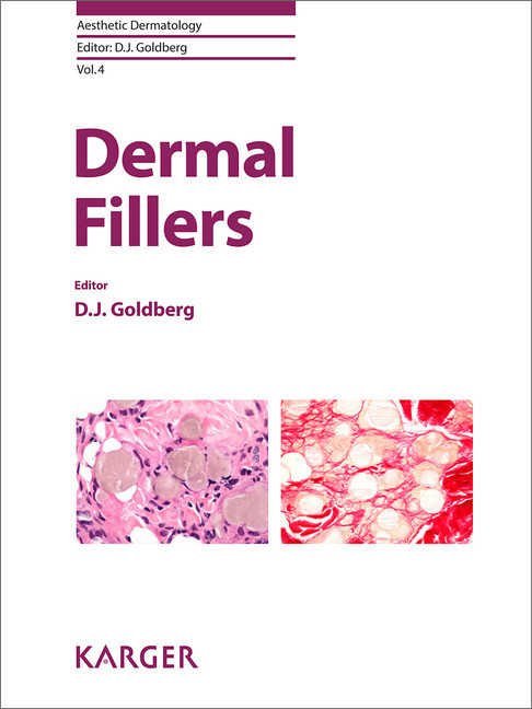 Dermal Fillers main product photo
