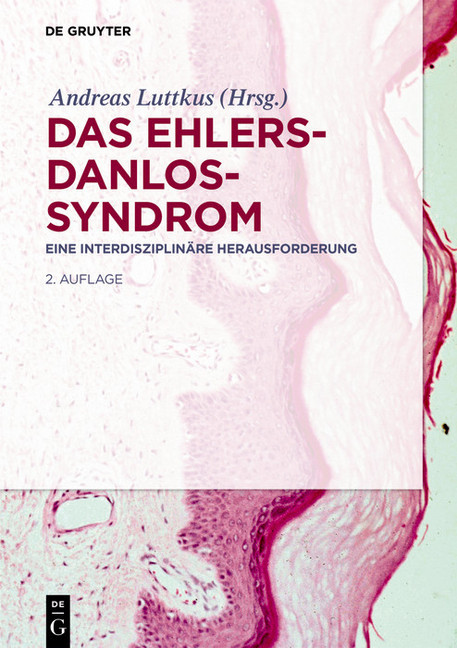 Das Ehlers-Danlos-Syndrom main product photo
