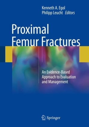 Proximal Femur Fractures
