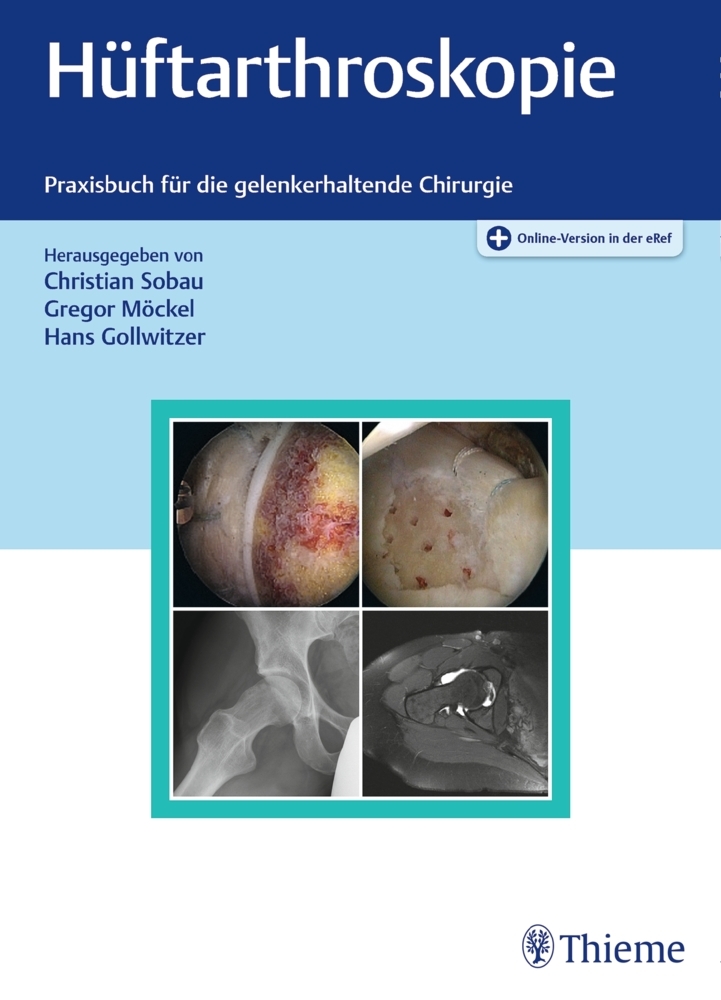 Hüftarthroskopie main product photo