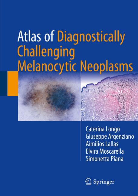 Atlas of Diagnostically Challenging Melanocytic Neoplasms main product photo