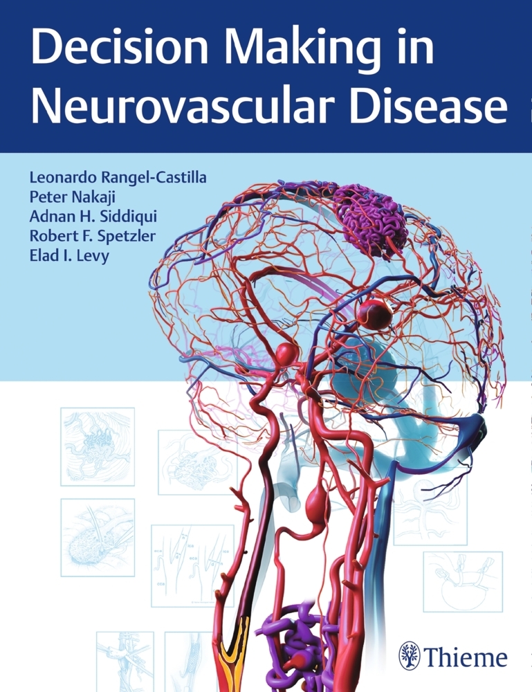 Decision Making in Neurovascular Disease main product photo