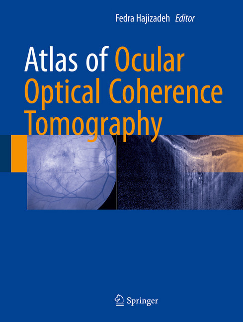 Atlas of Ocular Optical Coherence Tomography main product photo