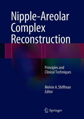 Nipple-Areolar Complex Reconstruction