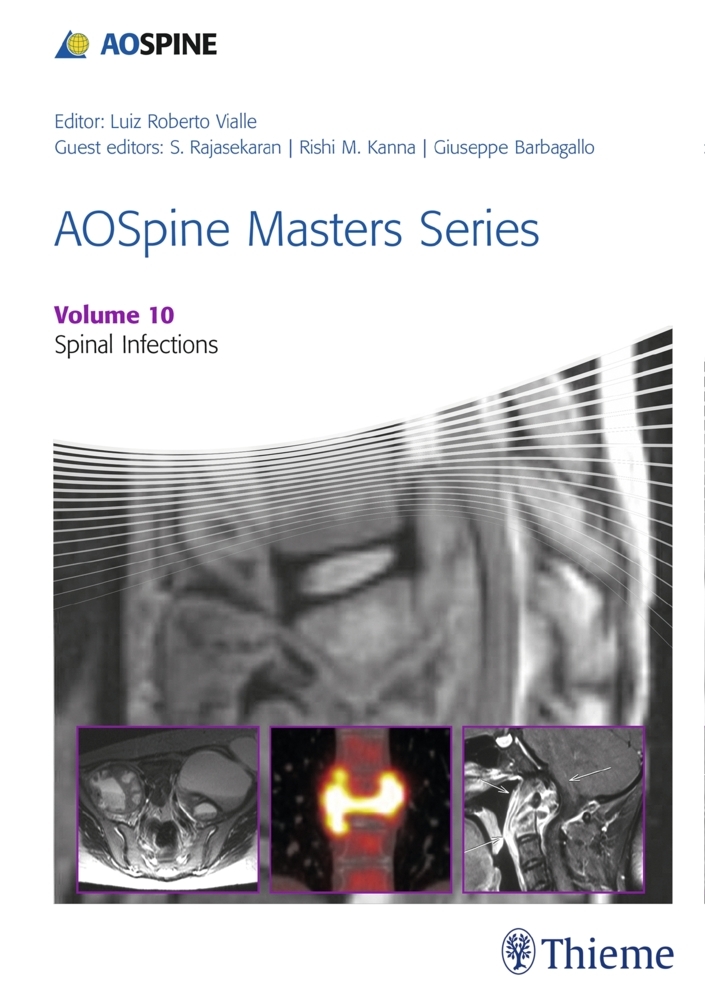 AOSpine Masters Series, Volume 10: Spinal Infections main product photo