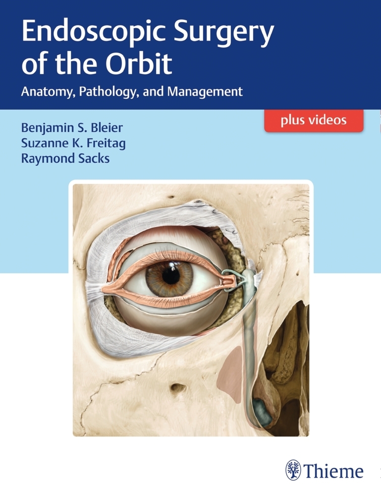 Endoscopic Surgery of the Orbit main product photo