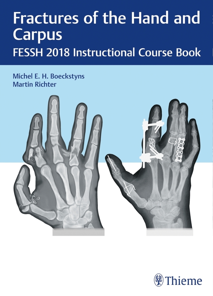 Fractures of the Hand and Carpus main product photo