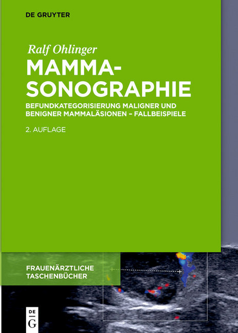 Mammasonographie main product photo