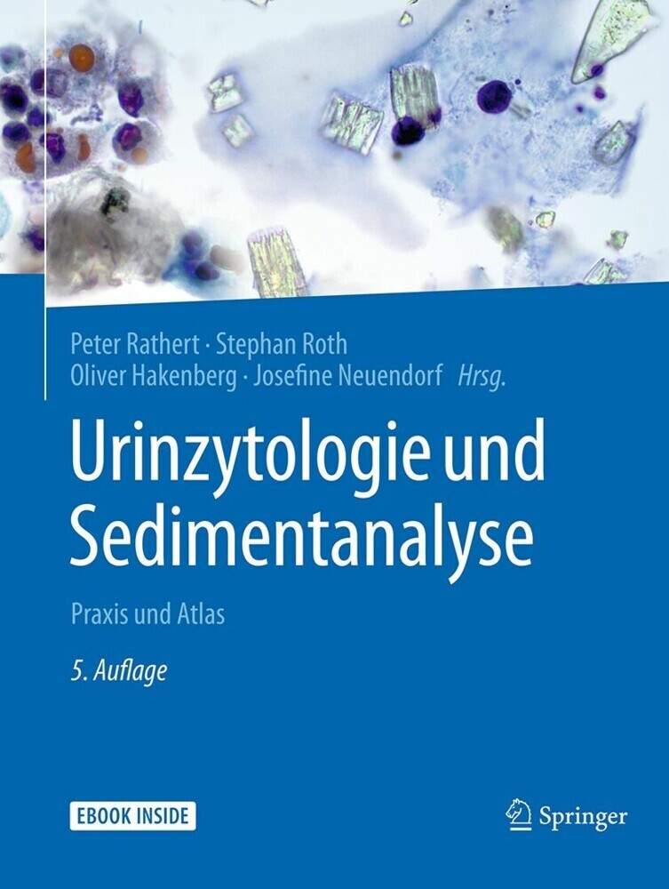 Urinzytologie und Sedimentanalyse main product photo