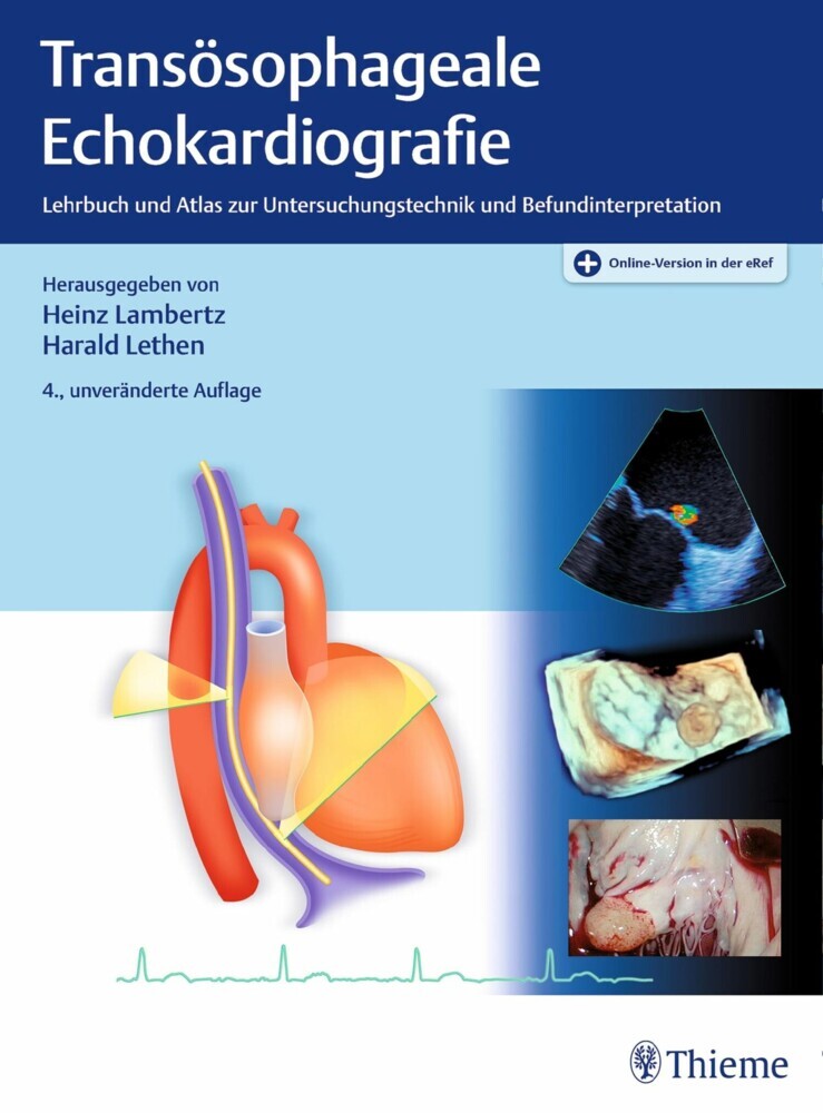 Transösophageale Echokardiografie main product photo