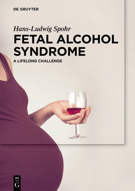 Fetal Alcohol Syndrome main product photo