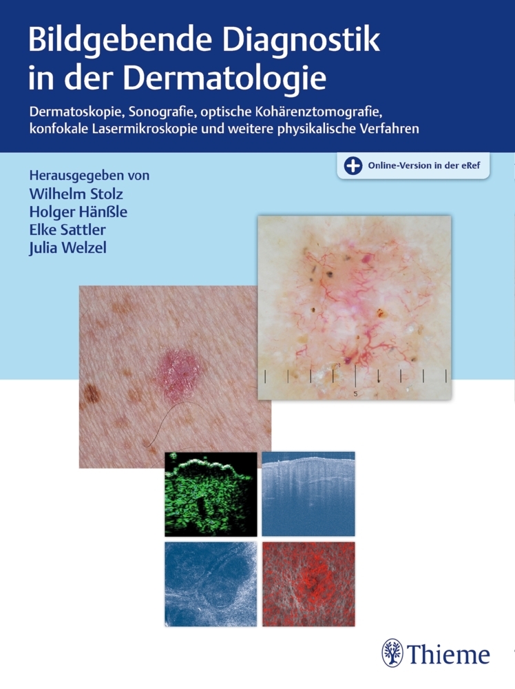 Bildgebende Diagnostik in der Dermatologie main product photo
