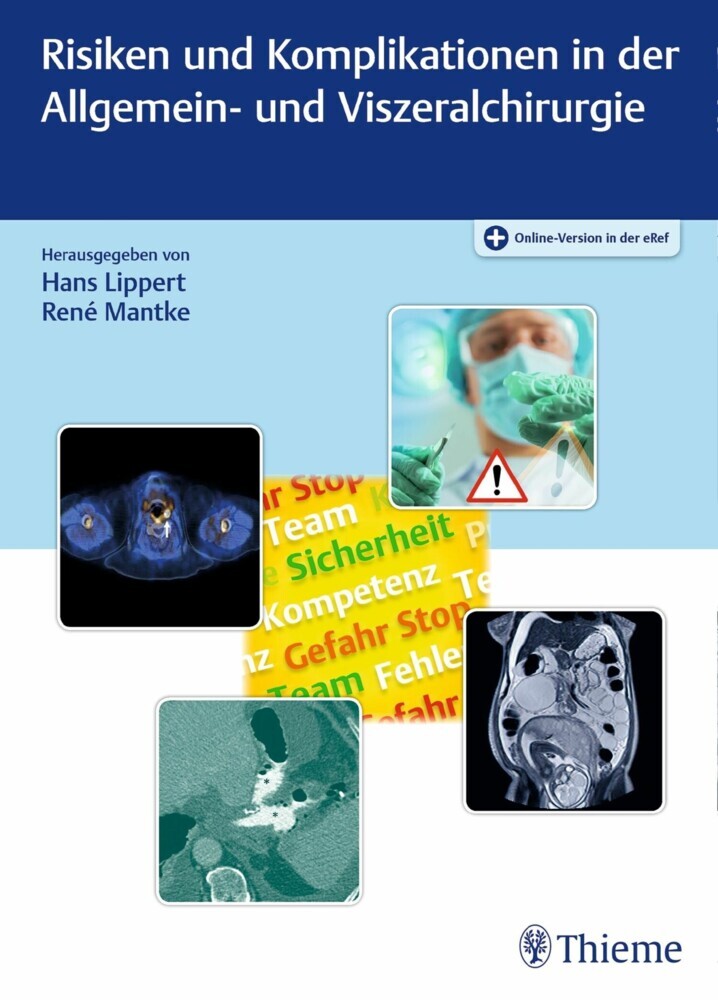 Risiken und Komplikationen in der Allgemein- und Viszeralchirurgie main product photo