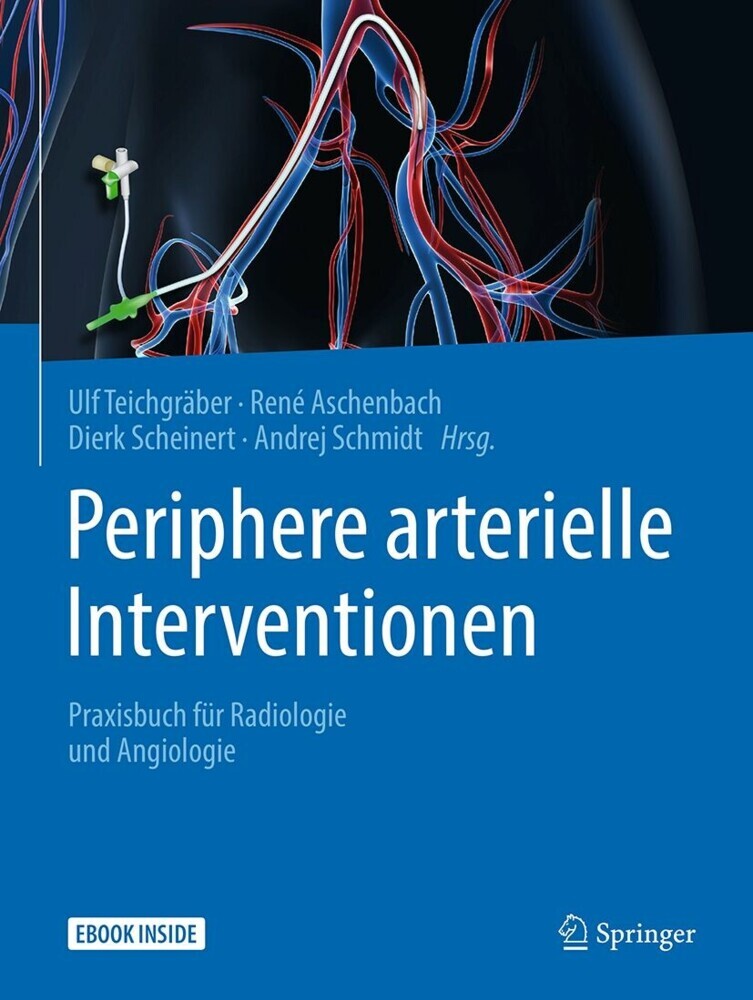 Periphere arterielle Interventionen main product photo