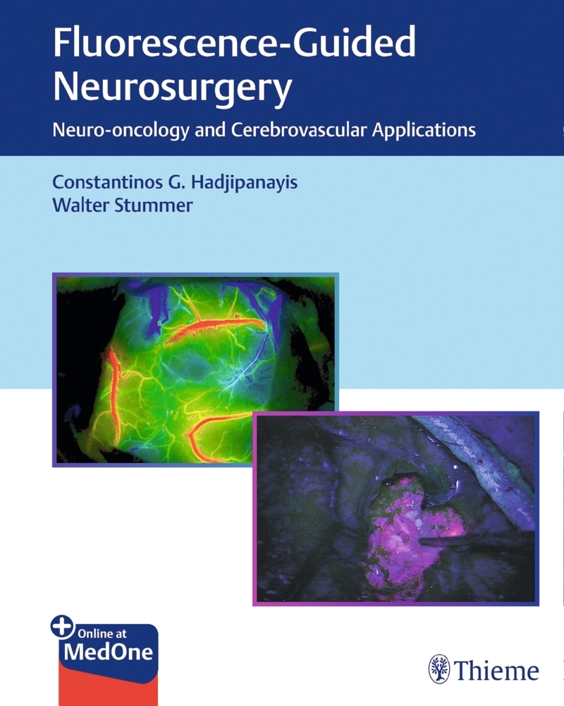 Fluorescence-Guided Neurosurgery main product photo