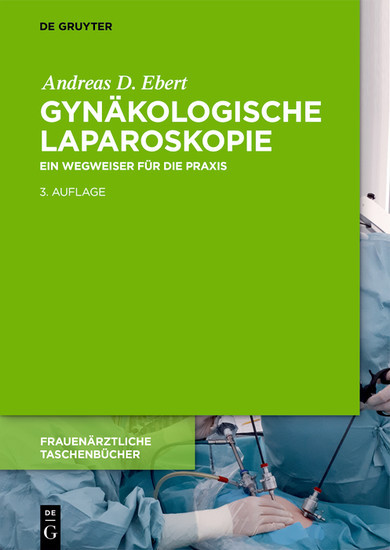 Gynäkologische Laparoskopie main product photo