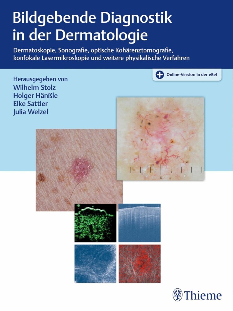 Bildgebende Diagnostik in der Dermatologie main product photo
