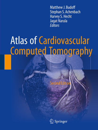 Atlas of Cardiovascular Computed Tomography main product photo