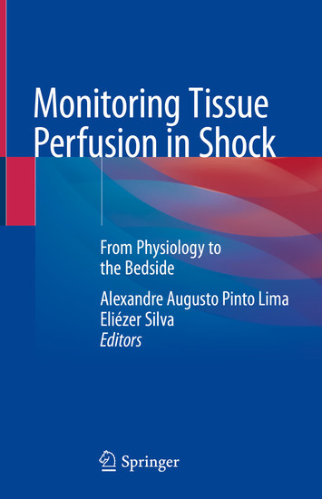 Monitoring Tissue Perfusion in Shock main product photo