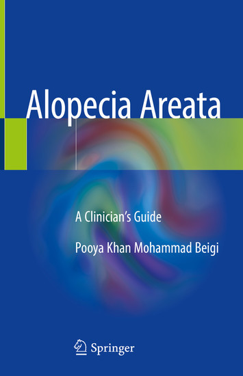 Alopecia Areata main product photo