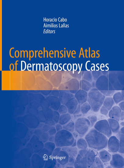 Comprehensive Atlas of Dermatoscopy Cases main product photo
