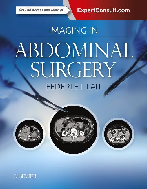 Imaging in Abdominal Surgery main product photo