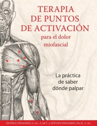 Terapia de puntos de activacion para el dolor miofascial