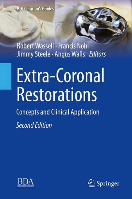 Extra-Coronal Restorations main product photo