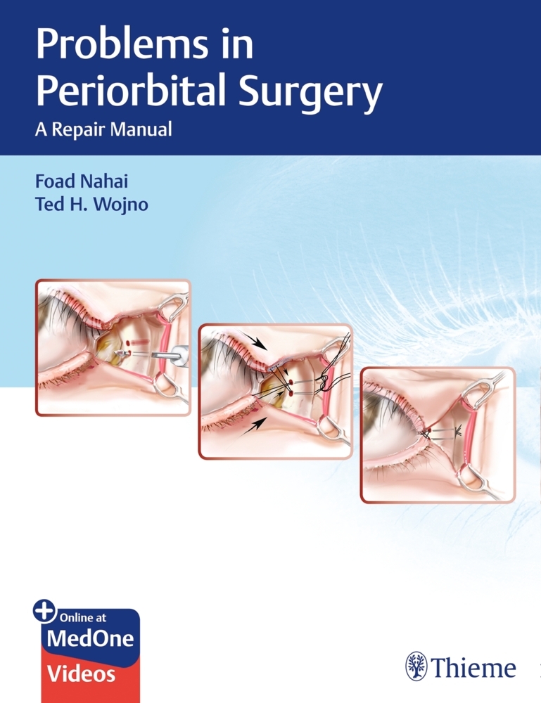 Problems in Periorbital Surgery main product photo