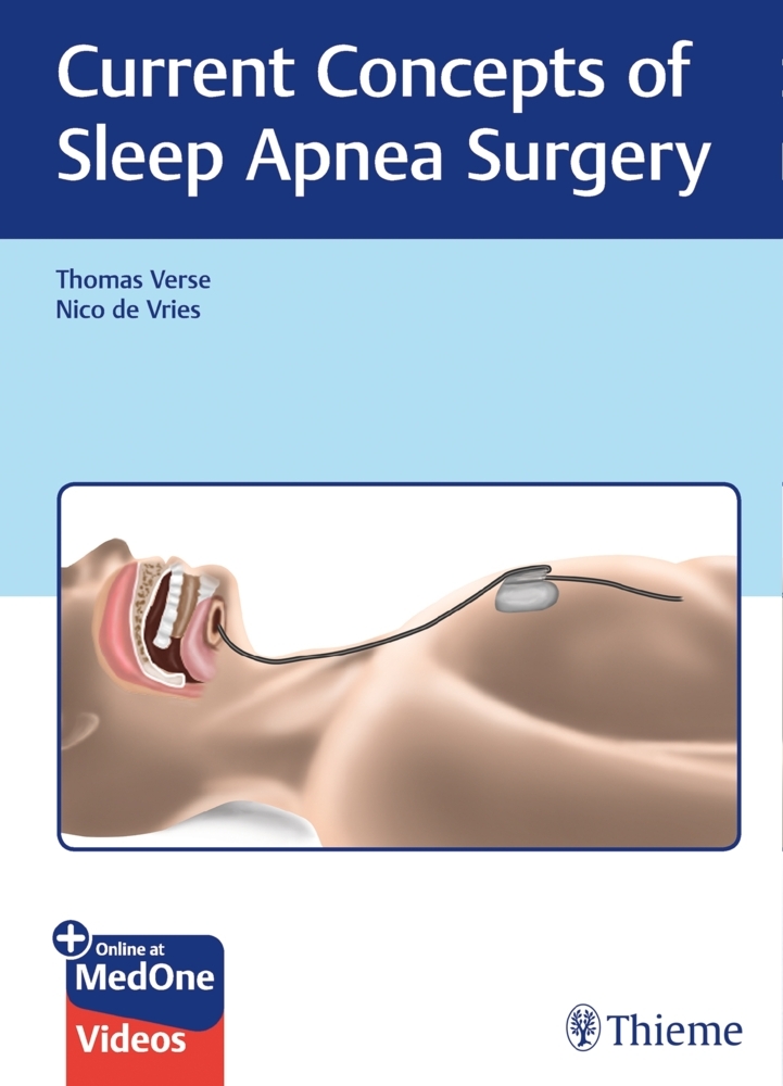 Current Concepts of Sleep Apnea Surgery main product photo