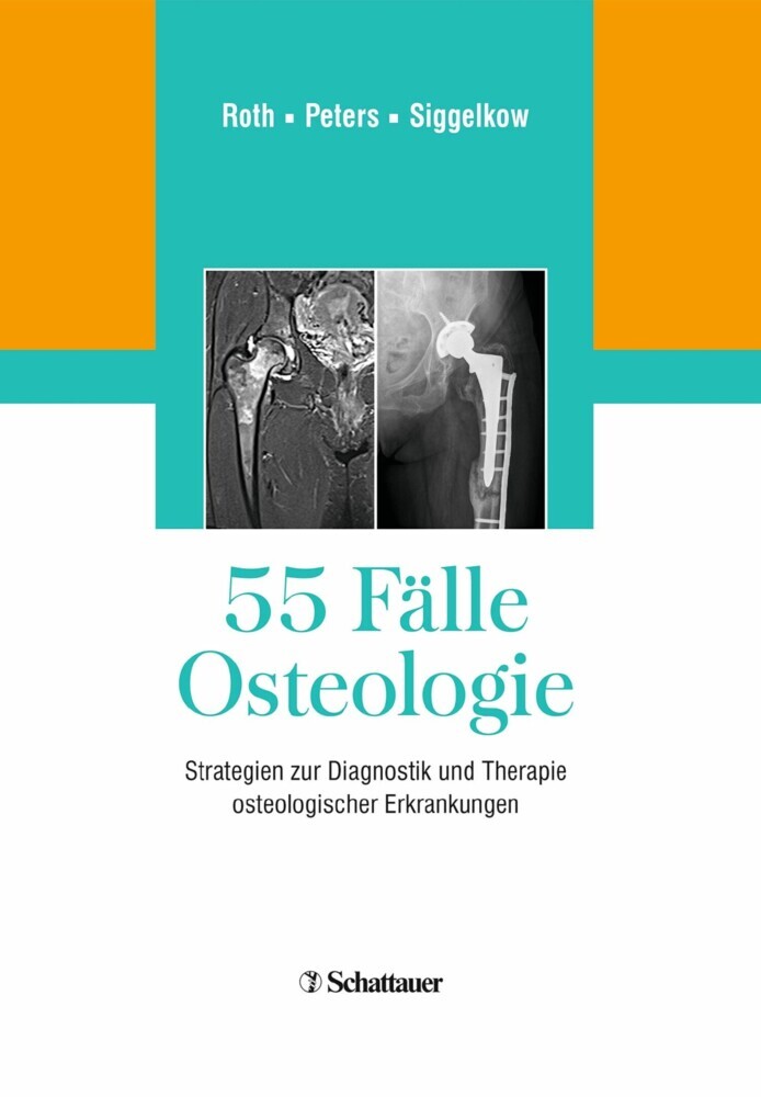 55 Fälle Osteologie main product photo