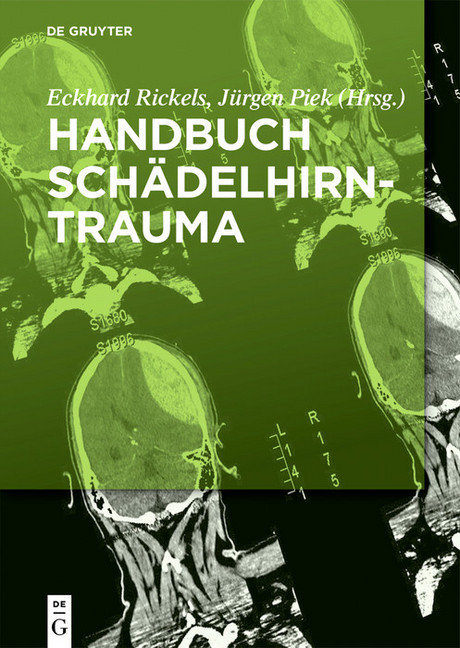 Handbuch Schädelhirntrauma main product photo