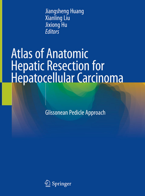 Atlas of Anatomic Hepatic Resection for Hepatocellular Carcinoma main product photo