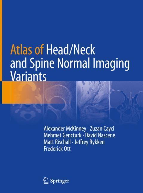 Atlas of Head/Neck and Spine Normal Imaging Variants main product photo