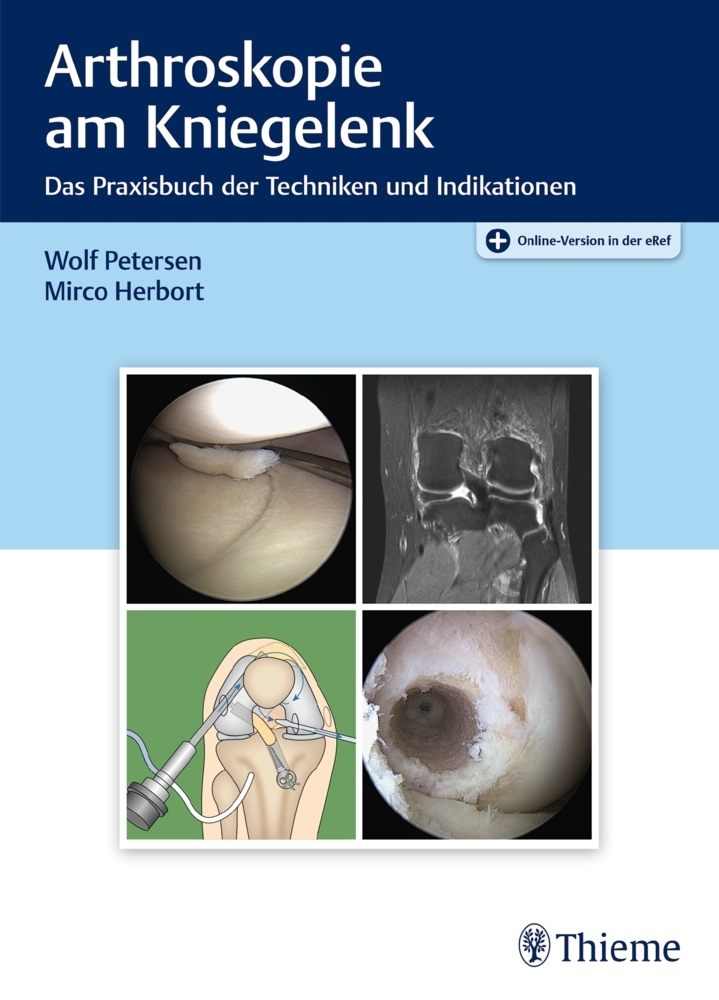 Arthroskopie am Kniegelenk main product photo