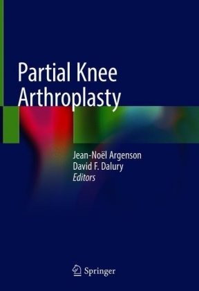 Partial Knee Arthroplasty