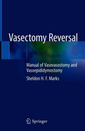 Vasectomy Reversal