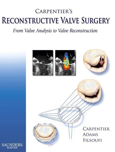 Carpentier's Reconstructive Valve Surgery main product photo