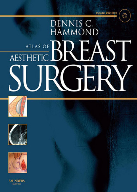 Atlas of Aesthetic Breast Surgery main product photo