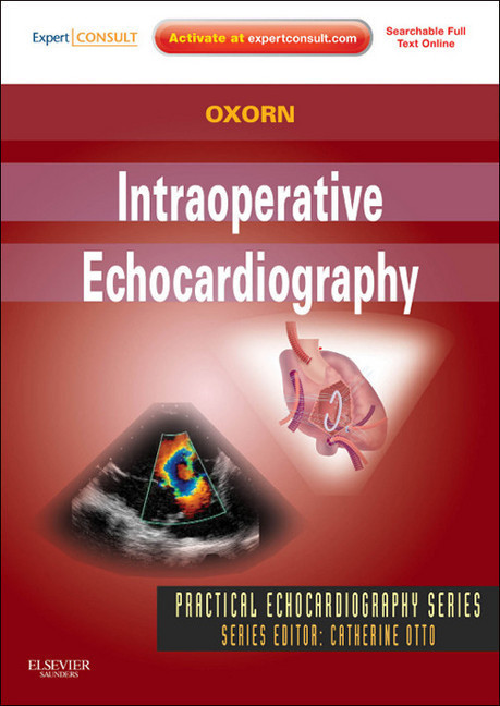Intraoperative Echocardiography main product photo