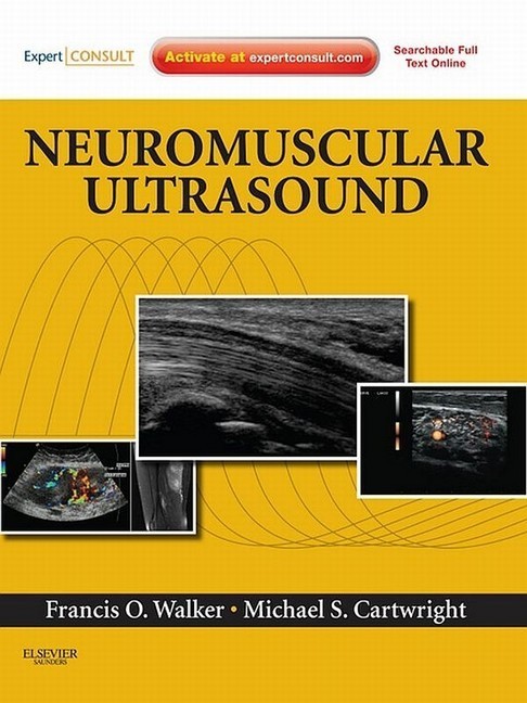 Neuromuscular Ultrasound main product photo