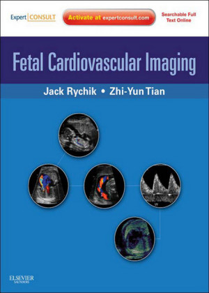 Fetal Cardiovascular Imaging