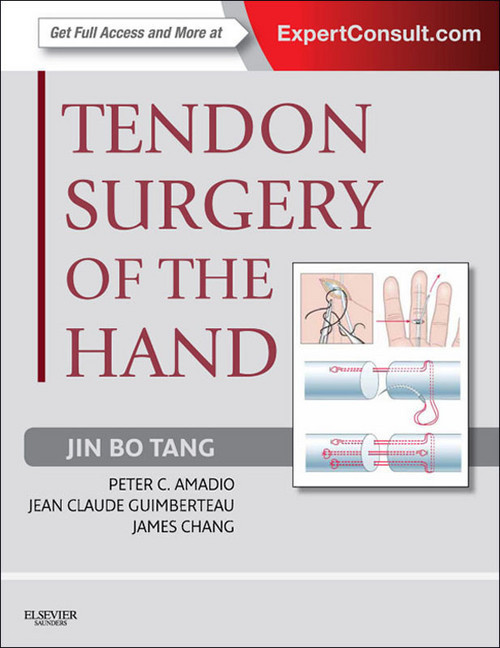Tendon Surgery of the Hand main product photo