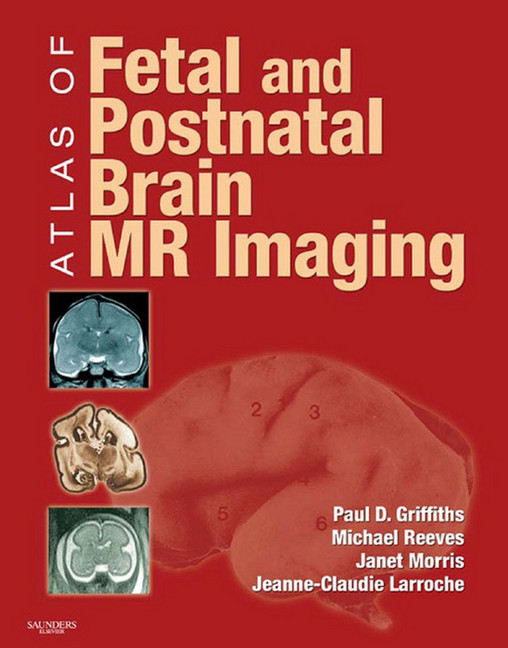 Atlas of Fetal and Infant Brain MR main product photo