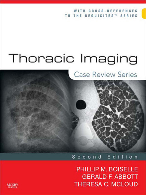 Thoracic Imaging main product photo