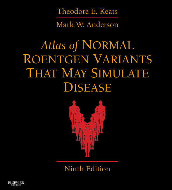 Atlas of Normal Roentgen Variants That May Simulate Disease E-Book main product photo