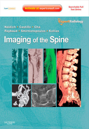Imaging of the Spine E-Book