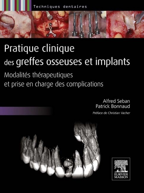 Pratique clinique des greffes osseuses et implants main product photo