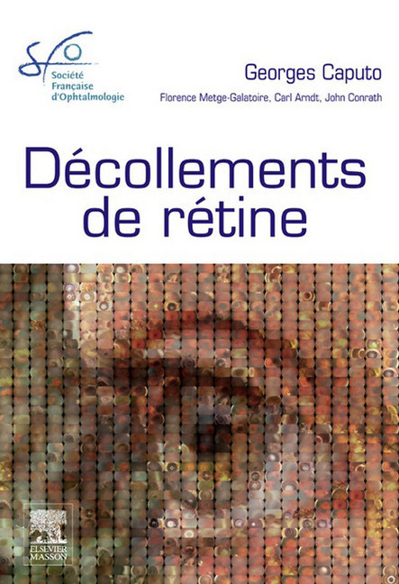 Décollements de rétine main product photo