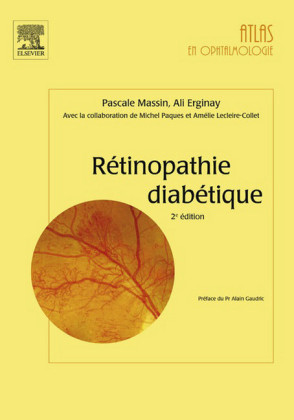 Rétinopathie diabétique